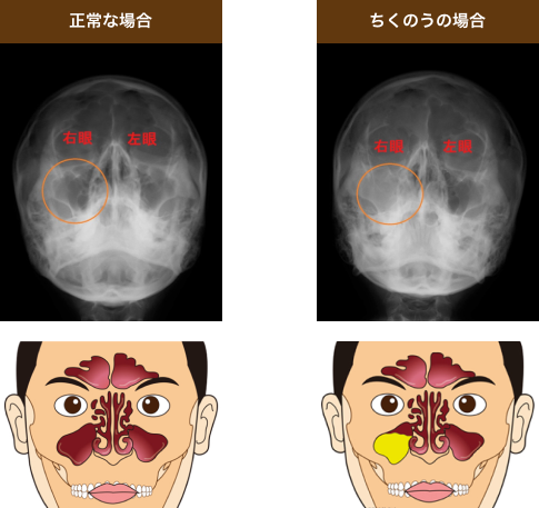 障害 年金 振込 通知 書 いつ 届く