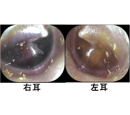 唾 を 飲む と 耳 が バリバリ