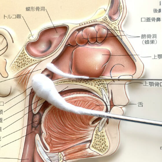 Bスポット療法（上咽頭擦過療法＝EAT）