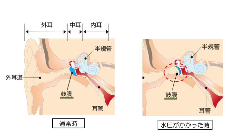 病気のはなし いのうえ耳鼻咽喉科