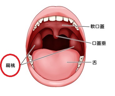 ノドに白いもの いのうえ耳鼻咽喉科