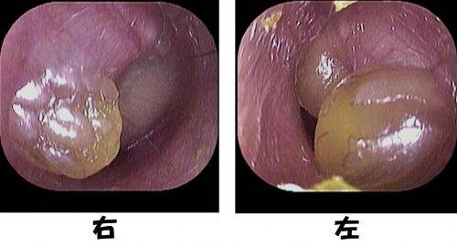 病気のはなし いのうえ耳鼻咽喉科