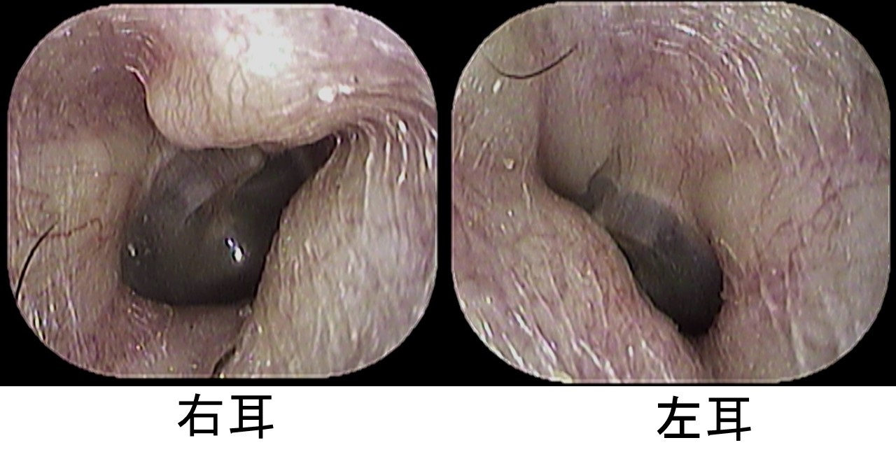 病気のはなし いのうえ耳鼻咽喉科