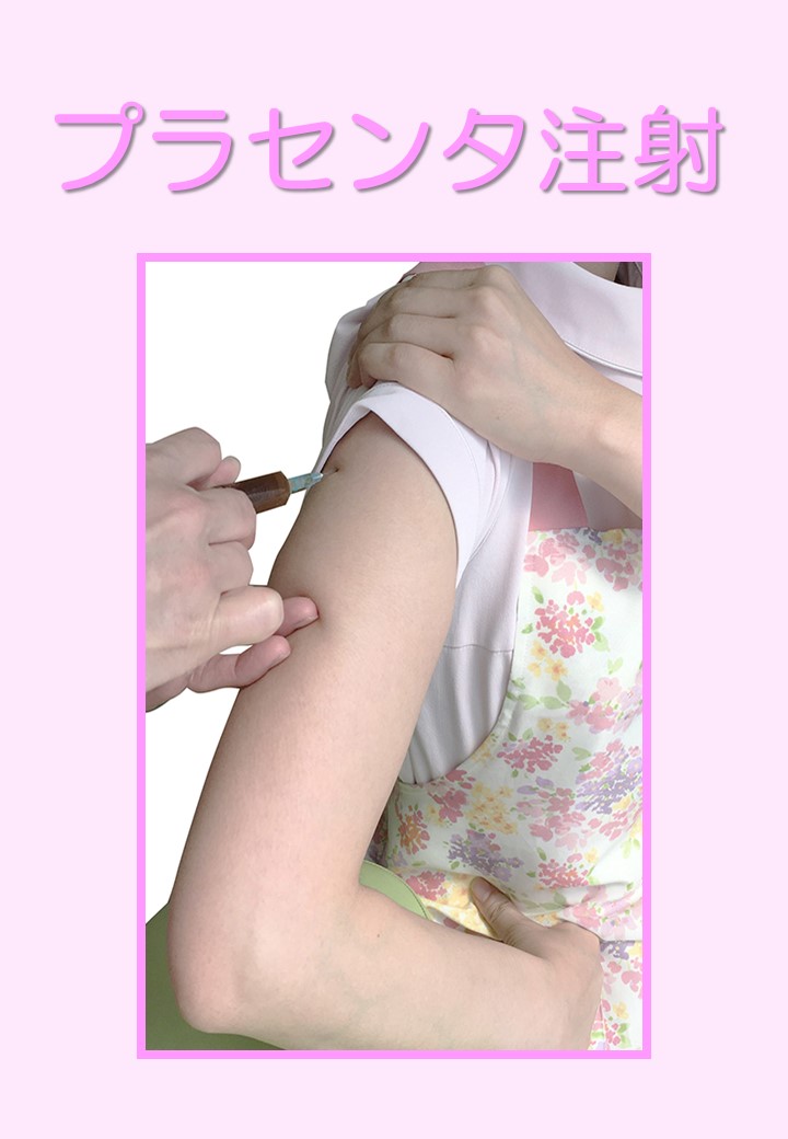 プラセンタ注射とにんにく注射 体験記 いのうえ耳鼻咽喉科 プラセンタ注射とにんにく注射 体験記 いのうえ耳鼻咽喉科