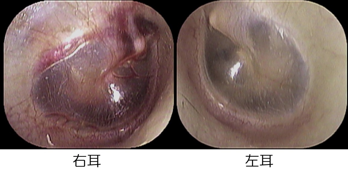 が 耳 と 唾 バリバリ を 飲む