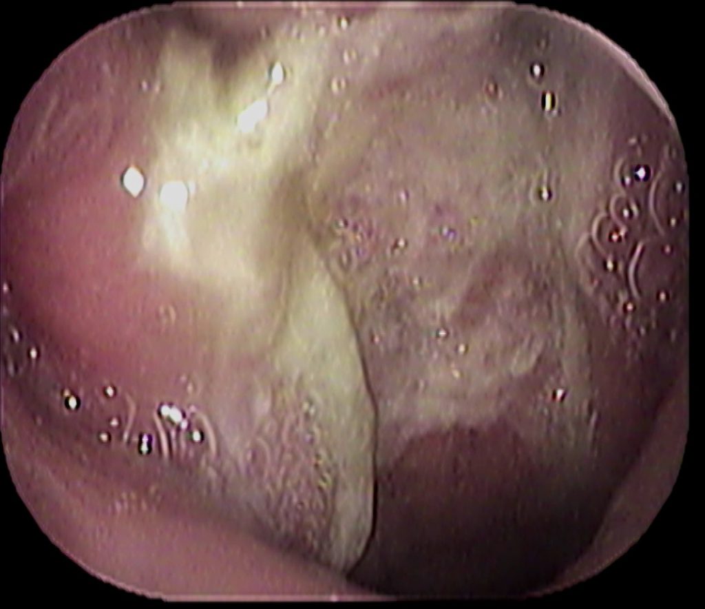 カテゴリ 診療について のブログ記事 いのうえ耳鼻咽喉科