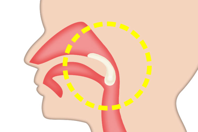 postnasal-drip-03