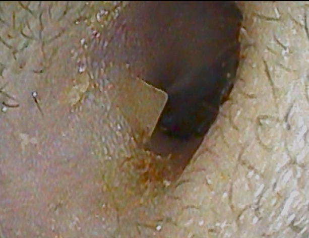 耳１