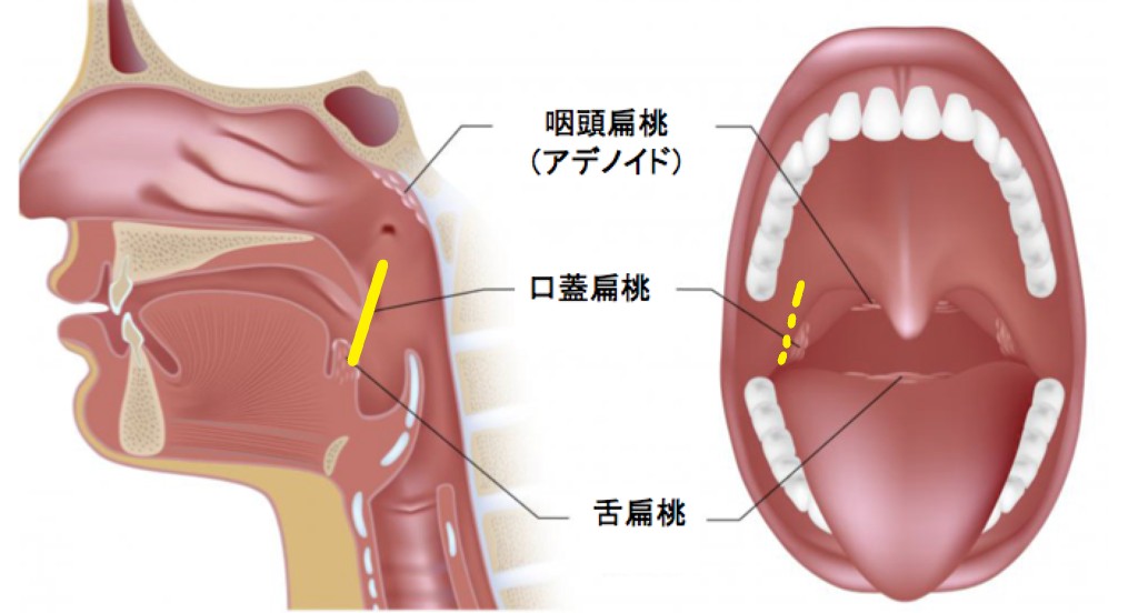 サバ３