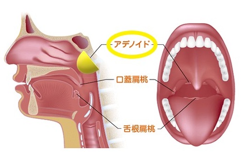 タイトル
