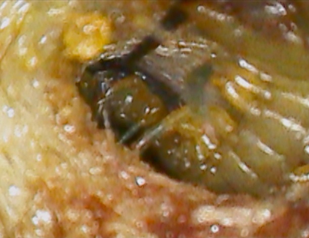 虫1
