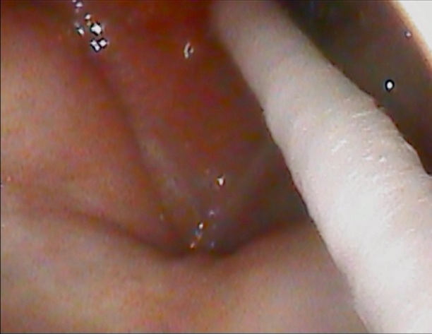 Ｂスポ２