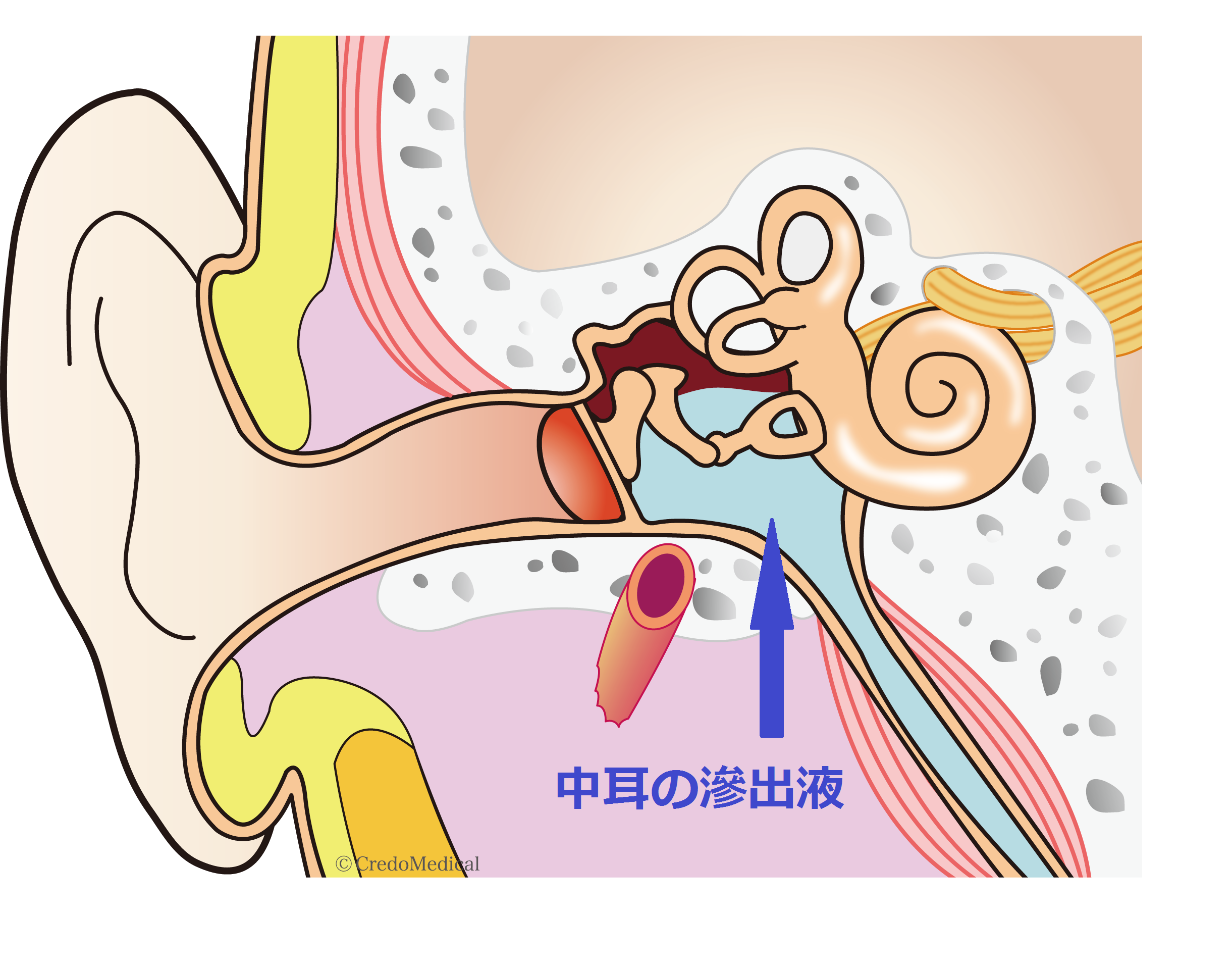 OME ロゴ入り図解耳別パターン