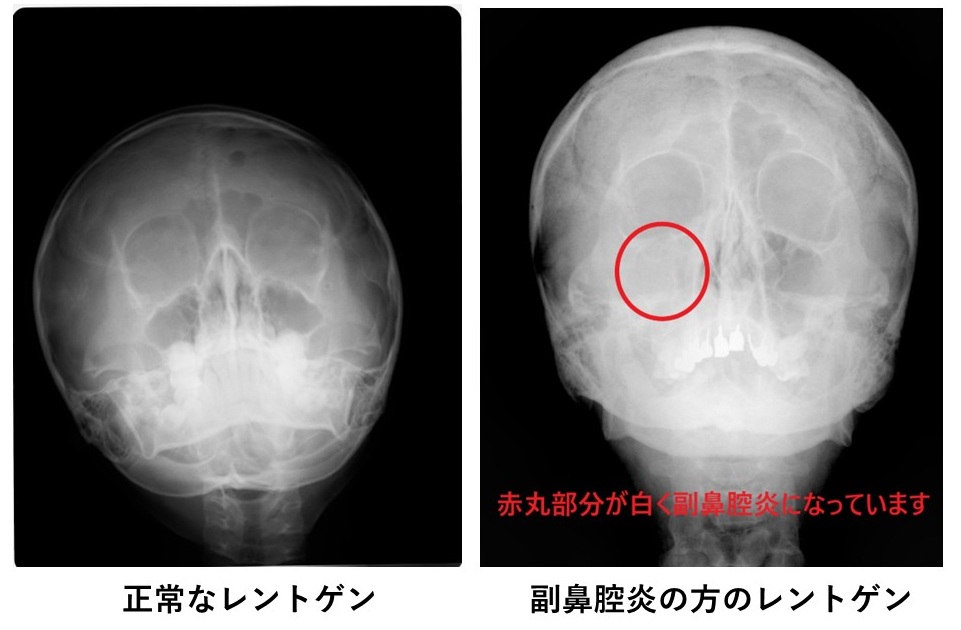 新規 Microsoft PowerPoint プレゼンテーション-1