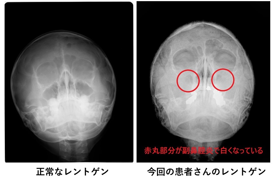 新規 Microsoft PowerPoint プレゼンテーション