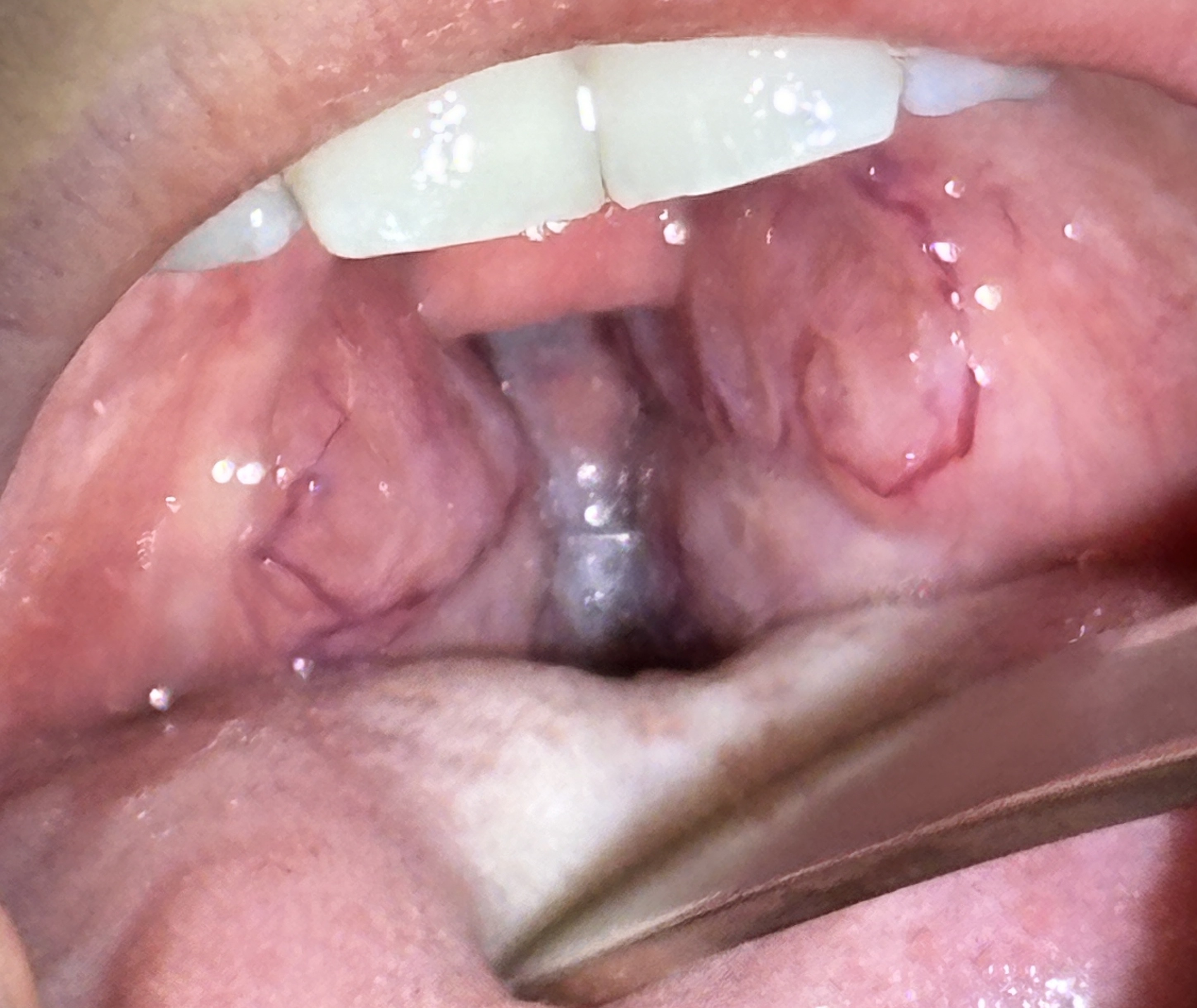 IMG_0387 - コピー