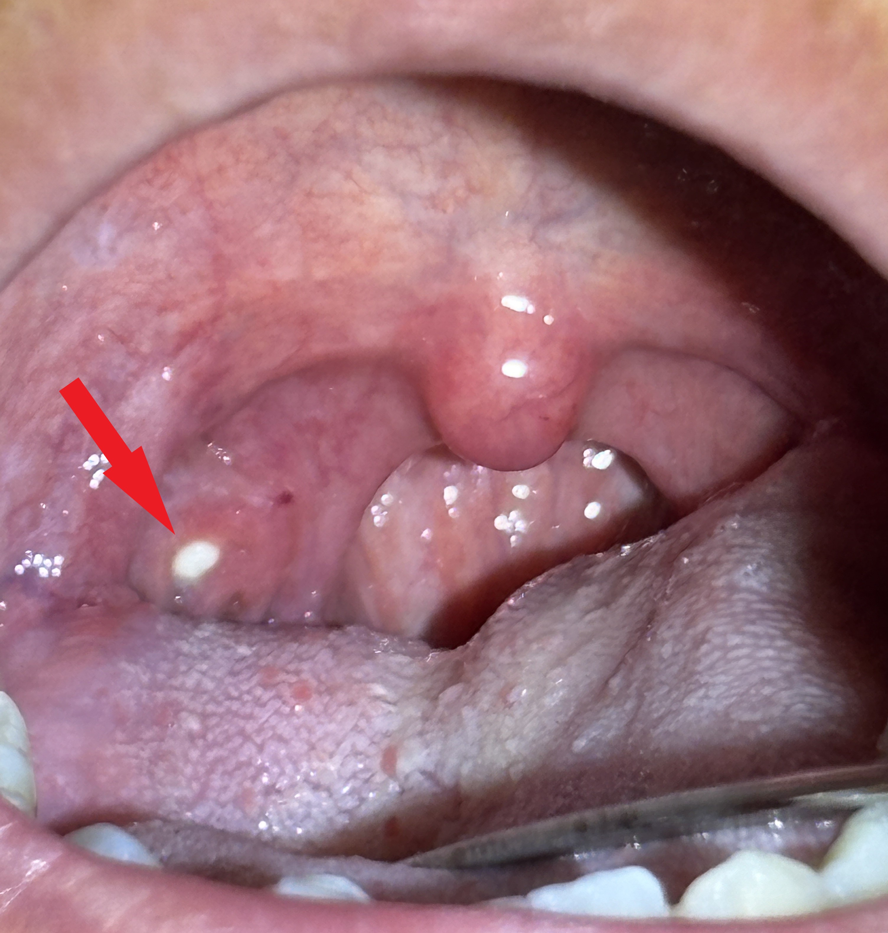 IMG_0922 - コピー - コピー