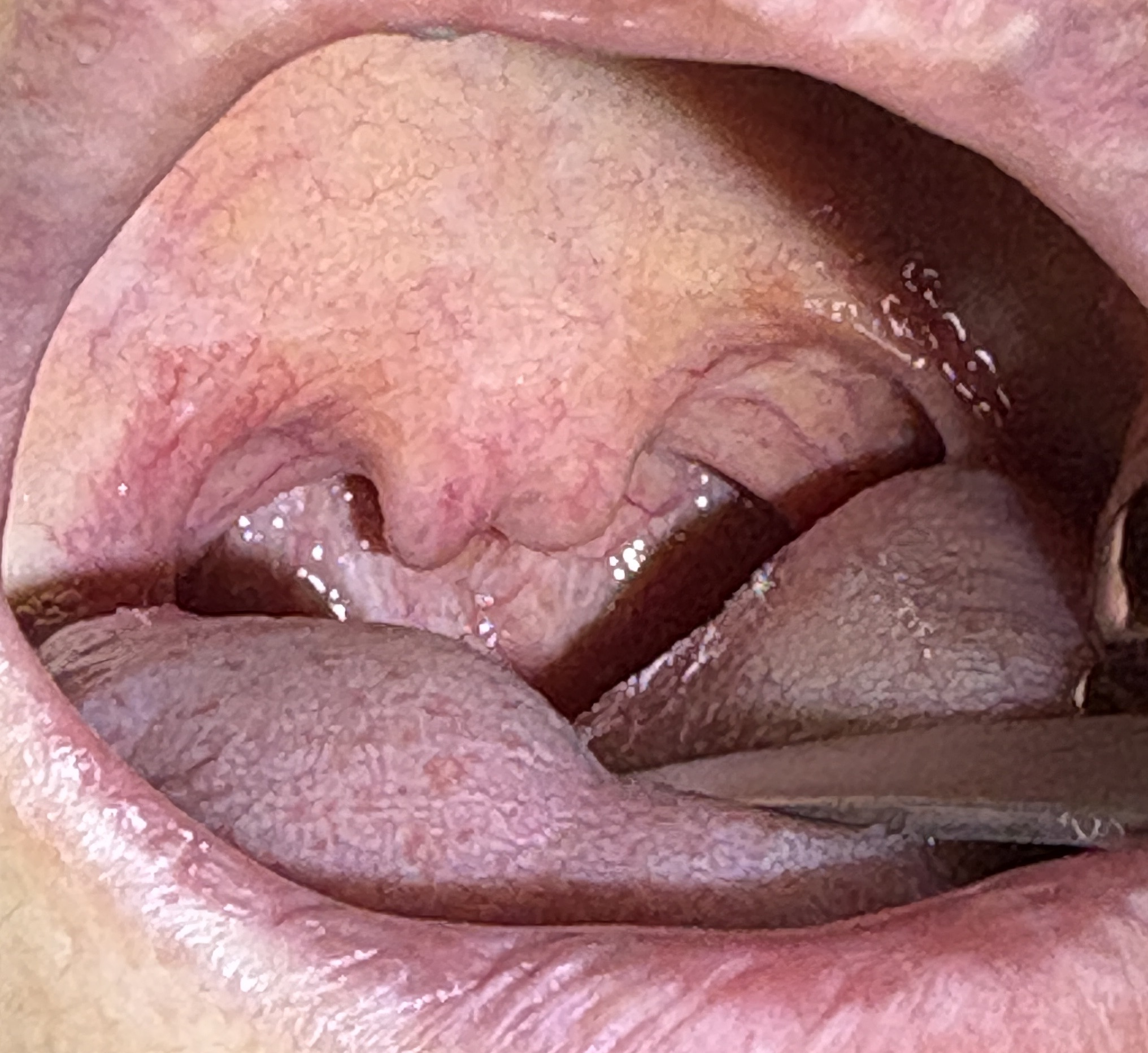 IMG_1103 - コピー