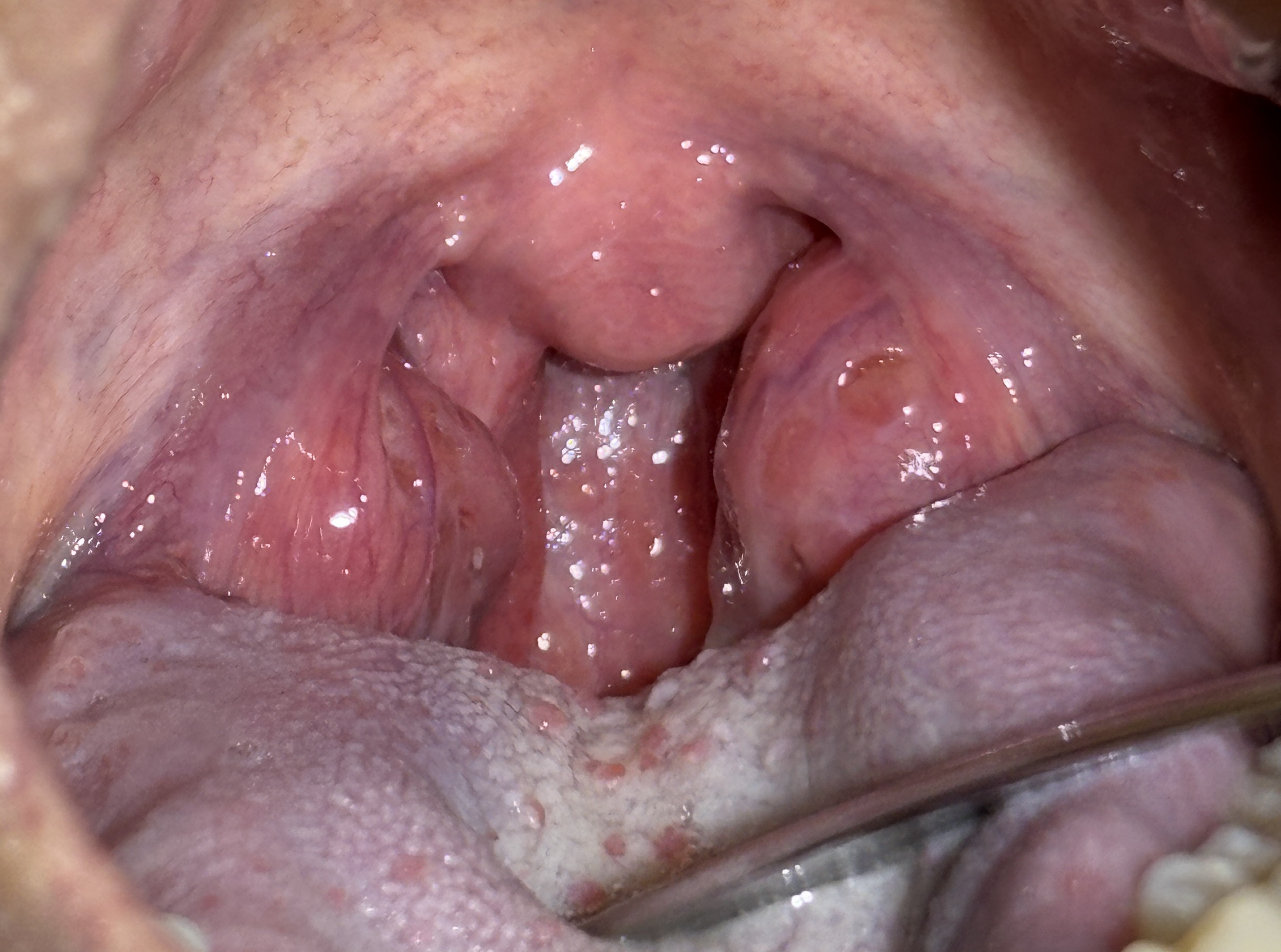 IMG_1116 - コピー