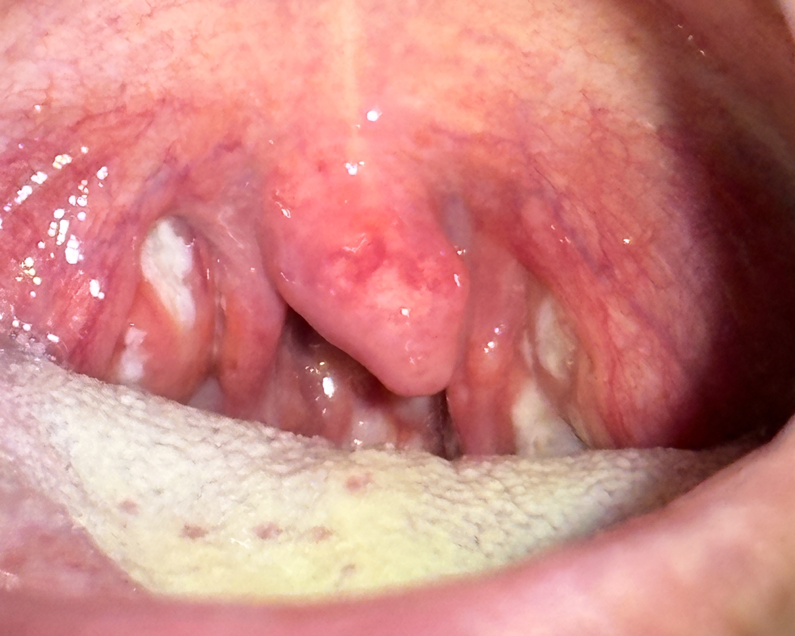 IMG_1204 - コピー