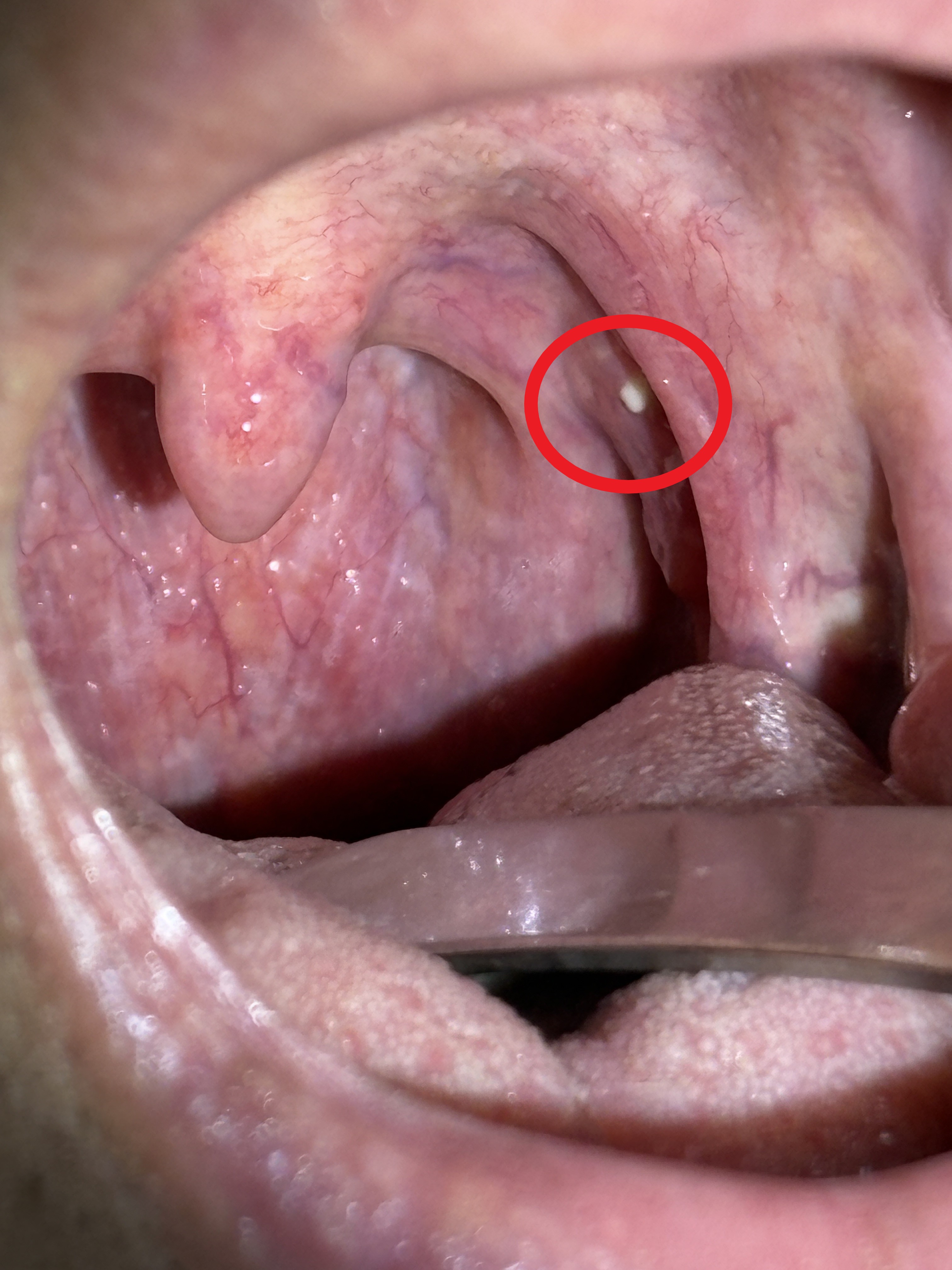 IMG_1349 - コピー