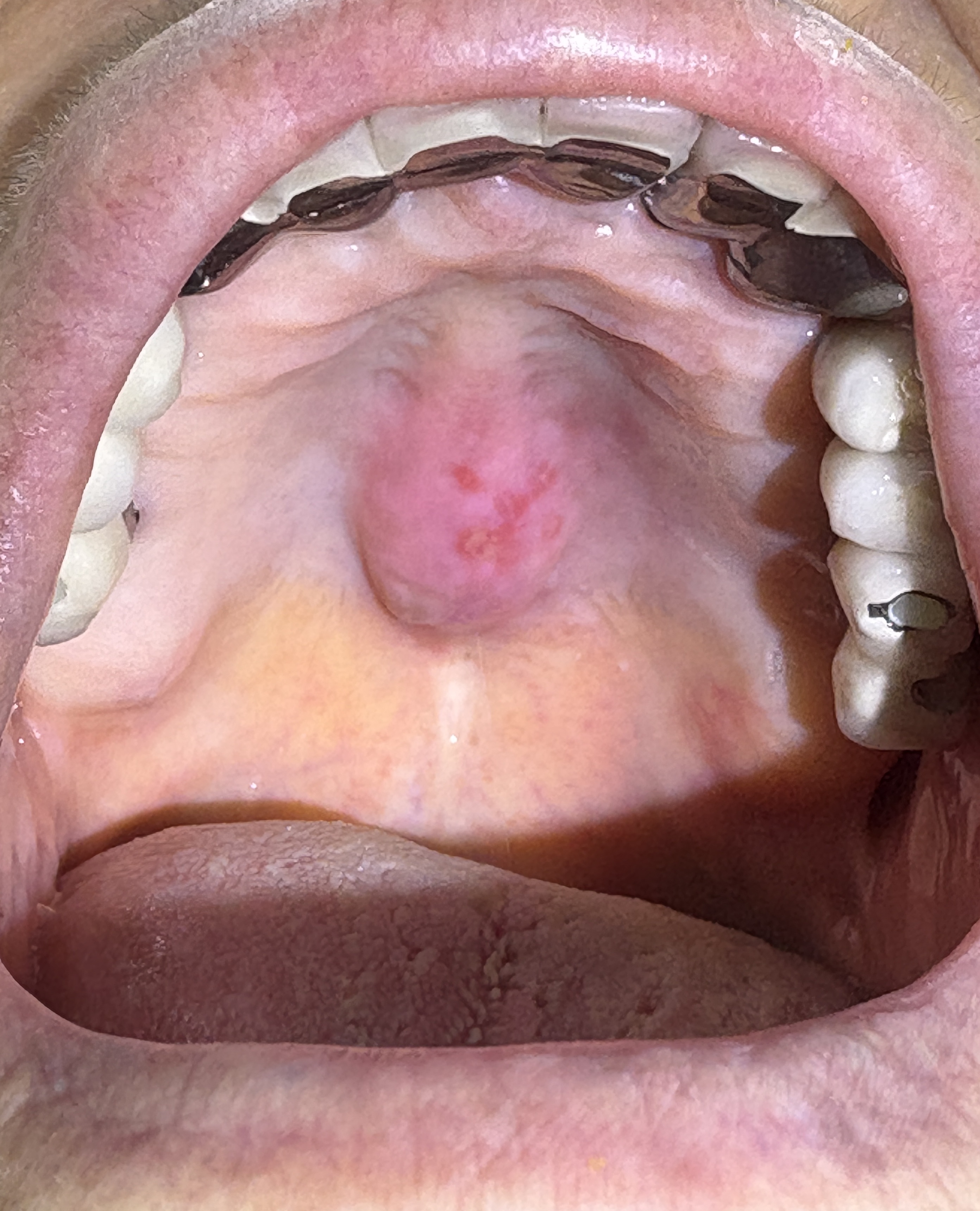 IMG_1484 - コピー