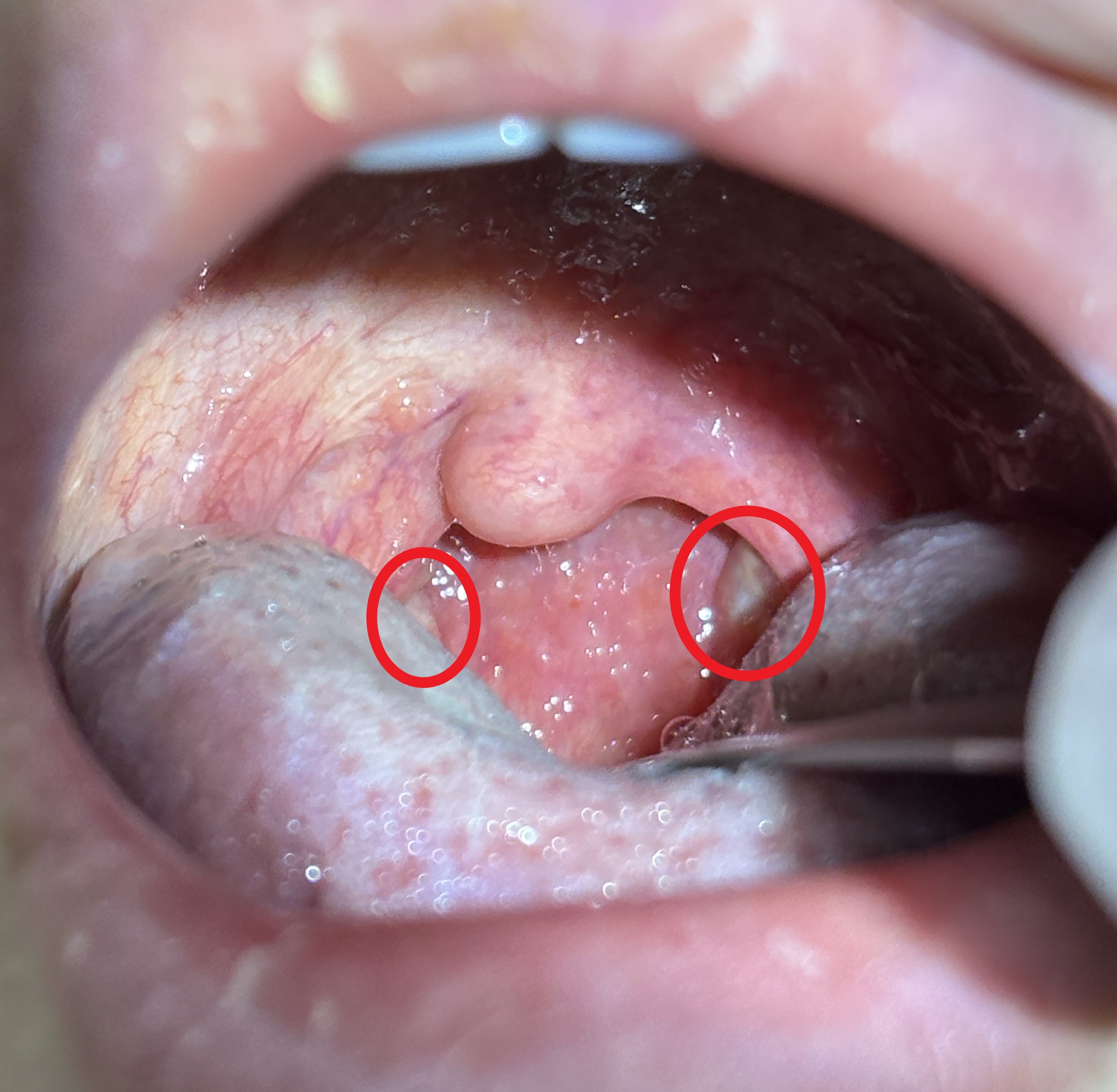 IMG_1501 - コピー