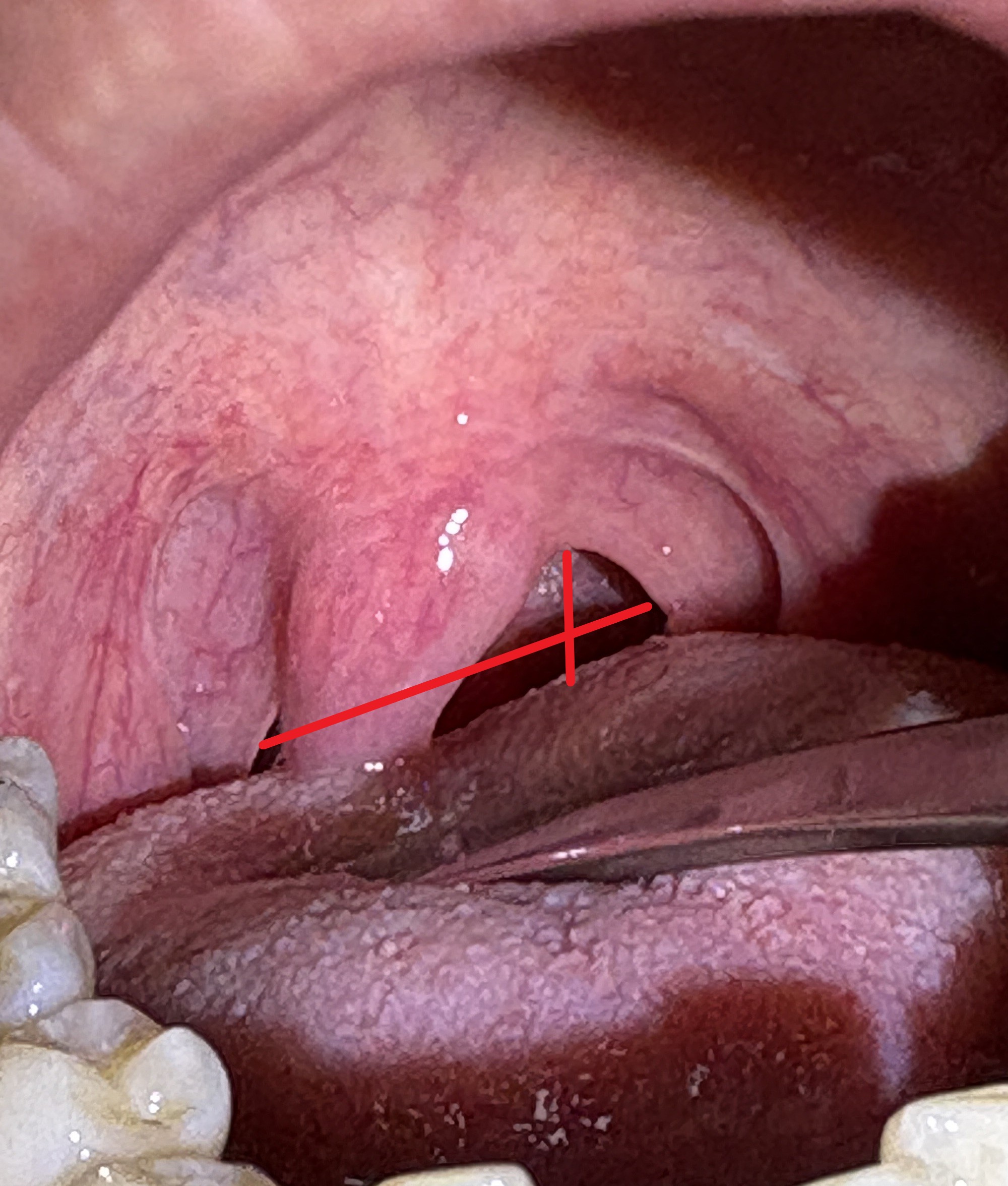 IMG_0985 - コピー - コピー