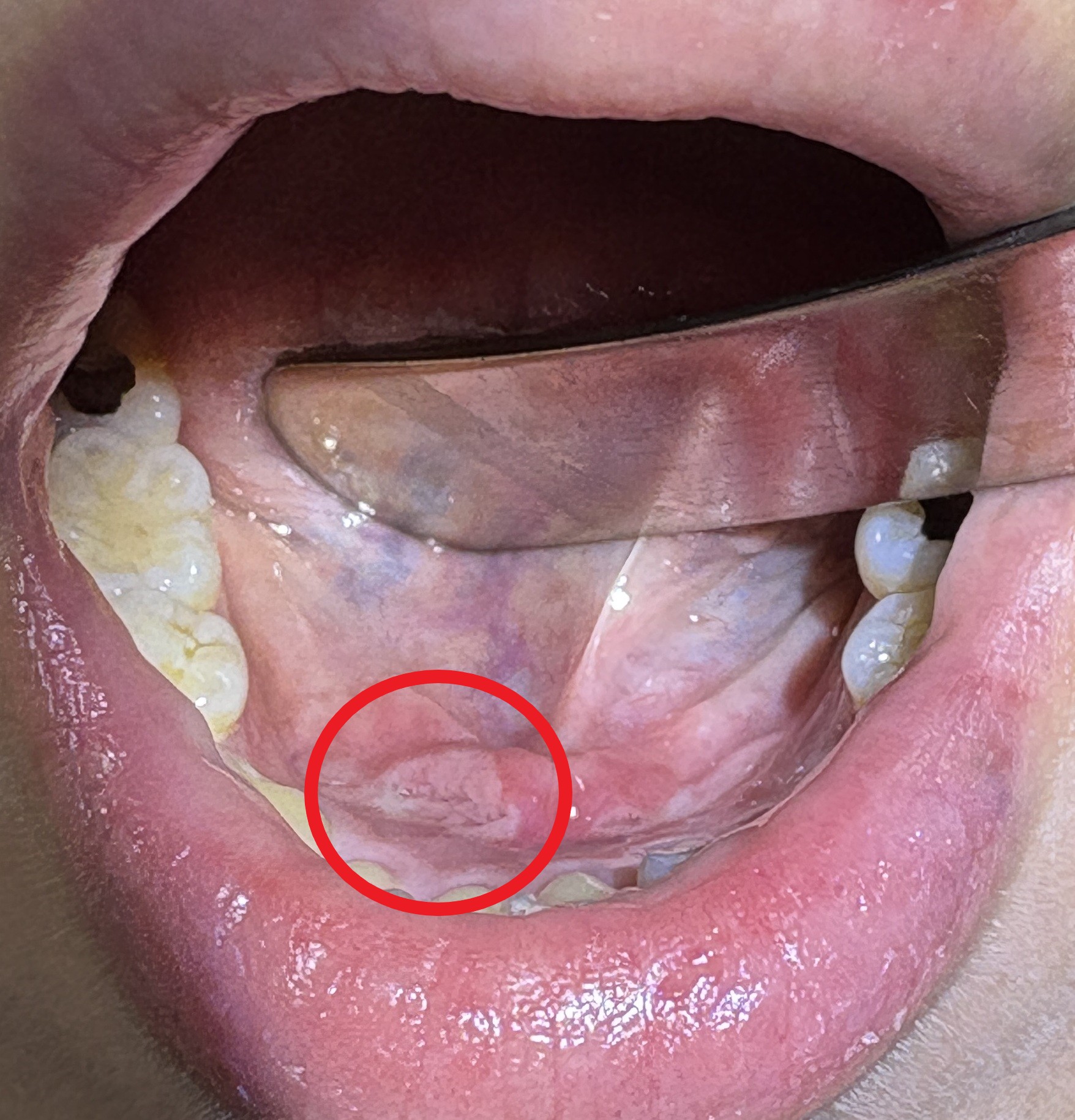 IMG_1799 - コピー - コピー