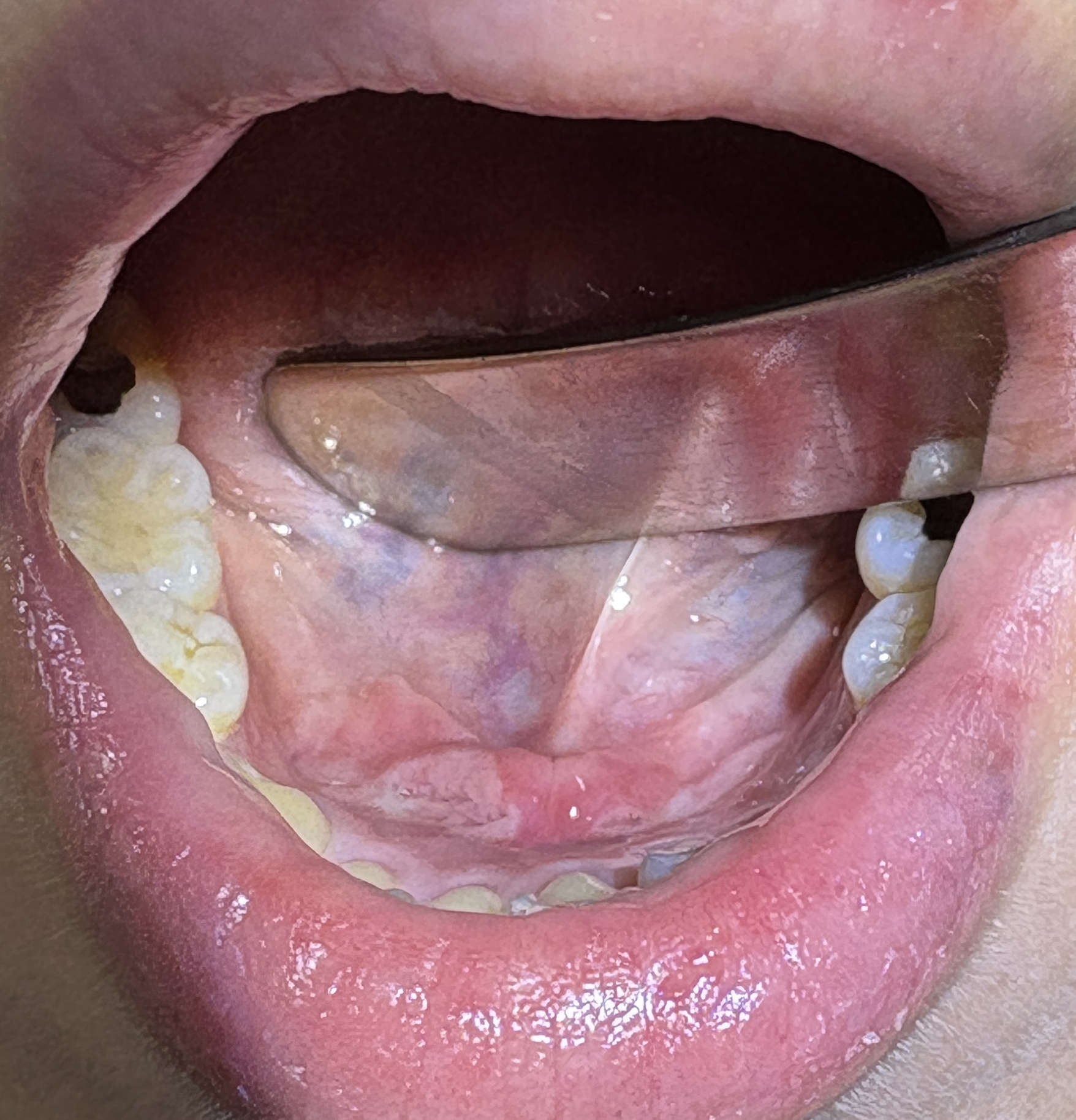 IMG_1799 - コピー