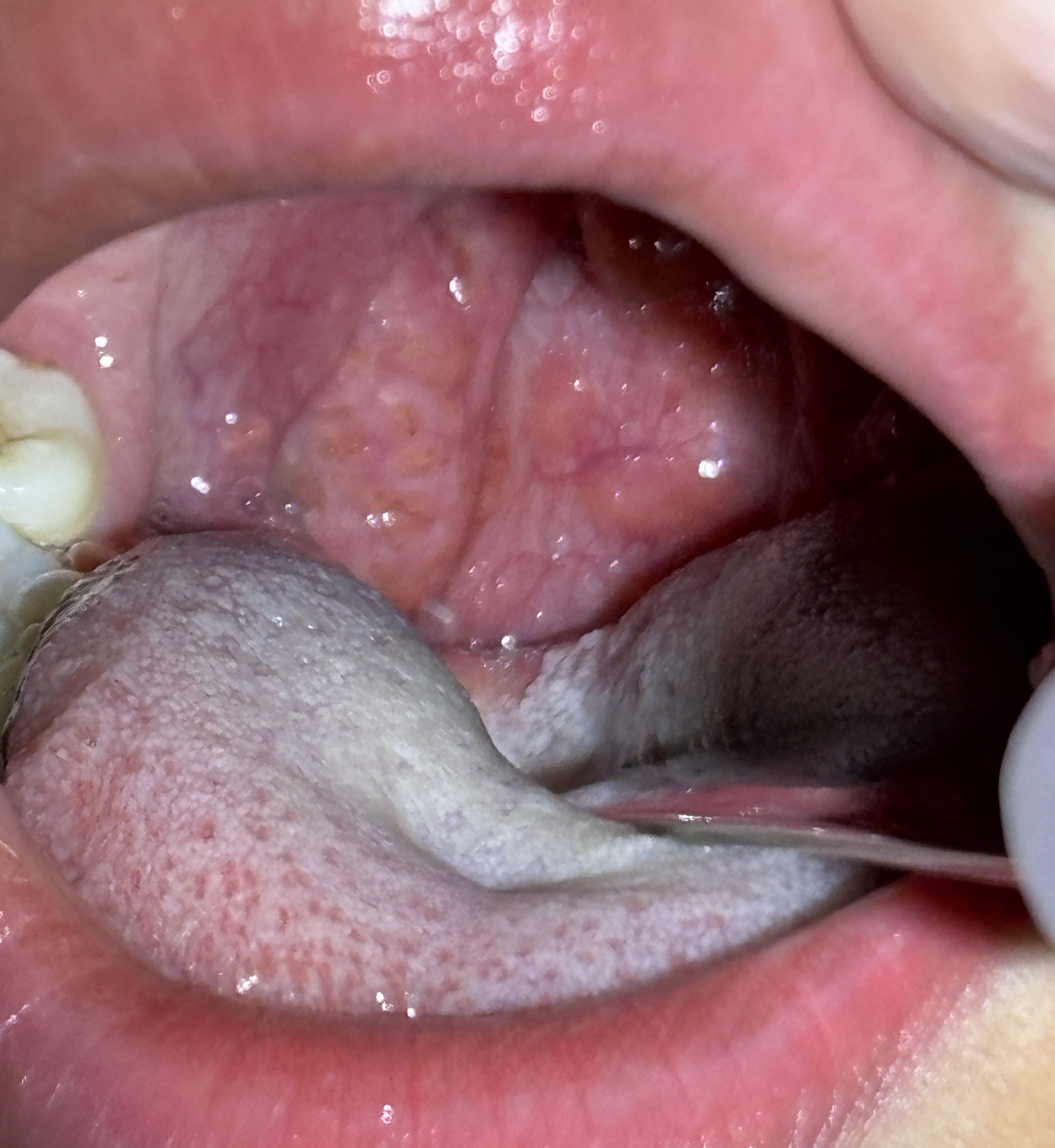 IMG_1823 - コピー