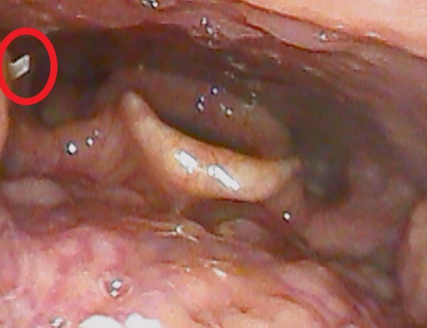 P-0000036972-260107-105038-01-01 - コピー