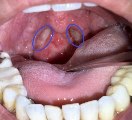 IMG_2246 - コピー