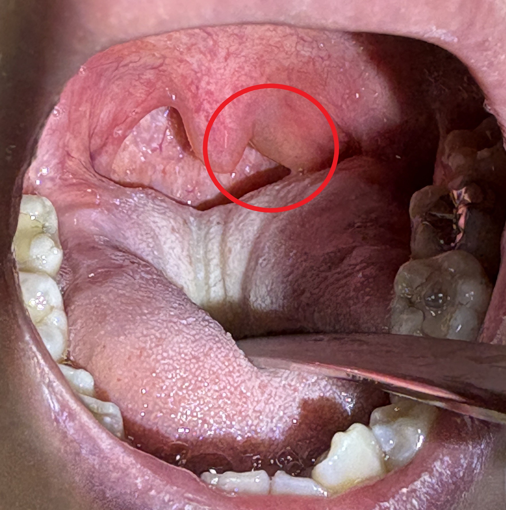 IMG_2403 - コピー - コピー