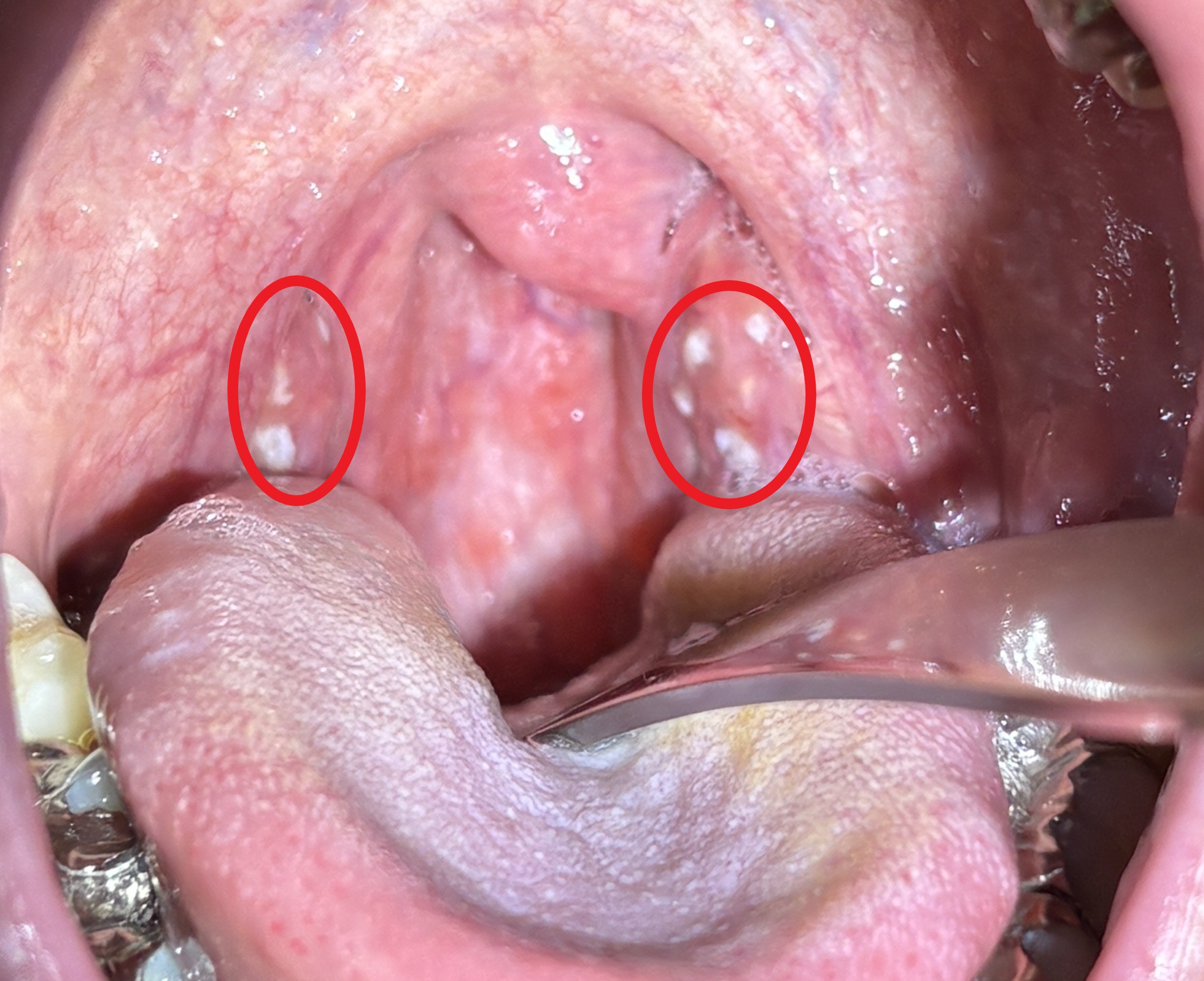 IMG_2828 - コピー - コピー