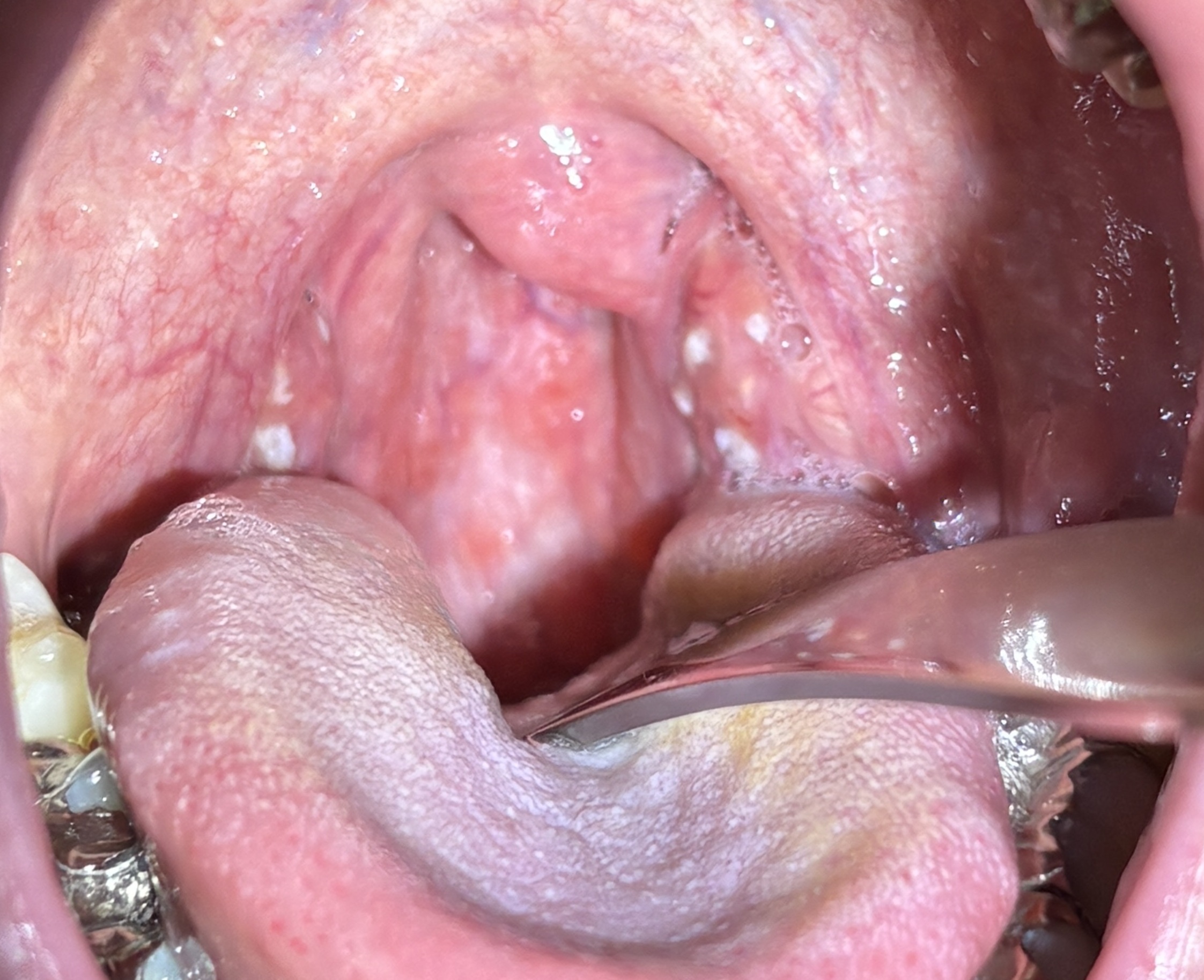 IMG_2828 - コピー